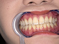 角名つむぎの超激レアな歯・口内・のどちんこ・唾観察 サンプル画像0008