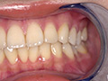 角名つむぎの超激レアな歯・口内・のどちんこ・唾観察 サンプル画像0010