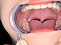角名つむぎの超激レアな歯・口内・のどちんこ・唾観察 サンプル画像0011