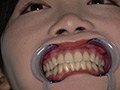 角名つむぎの超激レアな歯・口内・のどちんこ・唾観察 サンプル画像0012