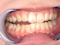 エマちゃんの歯・口内・舌ベロを観察してみた サンプル画像0002