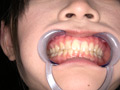 エマちゃんの歯・口内・舌ベロを観察してみた サンプル画像0004