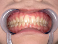 エマちゃんの歯・口内・舌ベロを観察してみた サンプル画像0005