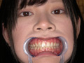 エマちゃんの歯・口内・舌ベロを観察してみた サンプル画像0006