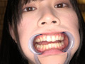 エマちゃんの歯・口内・舌ベロを観察してみた サンプル画像0007