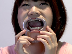 今回は素人ゆうちゃんの歯の調査！なすがまま歯の観察をされ、とても恥ずかしそうにしています。歯並びは結構きれいです。そんな彼女の口内は、所々虫歯がちらほら…奥には銀歯もあります。終始緊張している彼女の口内をぜひご堪能下さい。