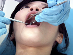 口腔：歯フェチ！処置室 さらちゃん 銀歯がキラリ