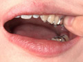 銀歯フェチ！口内歯観察 安達まどか サンプル画像0003