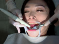 歯フェチ！本物の歯治療映像 小百合