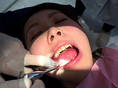 口腔：歯フェチ！本物歯治療映像色素沈着研磨除去＆歯石除去