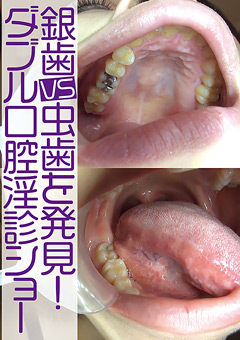 「銀歯vs虫歯を発見！ダブル口腔淫診ショー」のサンプル画像