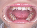 桐山結羽ちゃんのとっても貴重な歯・口内・舌フェチ動画 サンプル画像6