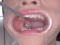 桐山結羽ちゃんのとっても貴重な歯・口内・舌フェチ動画 サンプル画像10