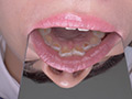 桐山結羽ちゃんのとっても貴重な歯・口内・舌フェチ動画 サンプル画像21