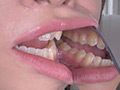 桐山結羽ちゃんのとっても貴重な歯・口内・舌フェチ動画 サンプル画像24