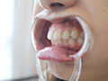 愛里るいちゃんの歯・のどちんこ・舌ベロフェチ！ サンプル画像4