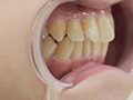 [adoa-0235] 涼城りおなの歯・口内・のどちんこ・舌ベロ観察・唾作品のキャプチャ画像 4