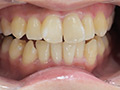 [adoa-0235] 涼城りおなの歯・口内・のどちんこ・舌ベロ観察・唾作品のキャプチャ画像 5