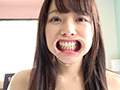 AD-278 宮沢ちはるチャンのエッチな歯＆舌ベロ＆口内動画！！！ 無料画像7