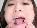 天希ユリナちゃんの貴重な口内・のどちんこ・銀歯観察 サンプル画像2