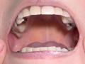 天希ユリナちゃんの貴重な口内・のどちんこ・銀歯観察 サンプル画像3