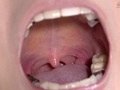 天希ユリナちゃんの貴重な口内・のどちんこ・銀歯観察 サンプル画像5