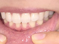 宮沢ちはるチャンの歯磨き＆歯・舌・のどちんこ・唾観察 サンプル画像7