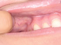 宮沢ちはるチャンの歯磨き＆歯・舌・のどちんこ・唾観察 サンプル画像8