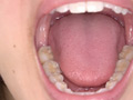 宮沢ちはるチャンの歯磨き＆歯・舌・のどちんこ・唾観察 サンプル画像9