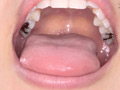 宮沢ちはるチャンの歯磨き＆歯・舌・のどちんこ・唾観察 サンプル画像11