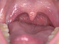 宮沢ちはるチャンの歯磨き＆歯・舌・のどちんこ・唾観察 サンプル画像12