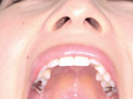 宮沢ちはるチャンの歯磨き＆歯・舌・のどちんこ・唾観察 サンプル画像13