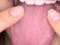 宮沢ちはるチャンの歯磨き＆歯・舌・のどちんこ・唾観察 サンプル画像15