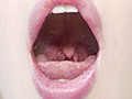 [adoa-0338] 朝日しずくチャンの歯・のどちんこ・舌ベロ観察！