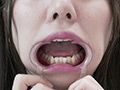 朝日しずくチャンの歯・のどちんこ・舌ベロ観察！ サンプル画像15