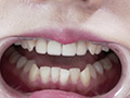 朝日しずくチャンの歯・のどちんこ・舌ベロ観察！ サンプル画像18