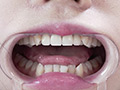 朝日しずくチャンの歯・のどちんこ・舌ベロ観察！ サンプル画像21