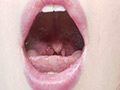 朝日しずくチャンの歯・のどちんこ・舌ベロ観察！ サンプル画像25