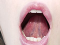 朝日しずくチャンの歯・のどちんこ・舌ベロ観察！ サンプル画像28