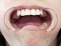 【歯・舌ベロ】素人モデル まみチャンの歯・舌ベロ観察 サンプル画像18