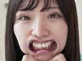 【歯・舌ベロ】素人モデル まみチャンの歯・舌ベロ観察 画像19