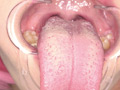 リゼロのラ●（香苗レノン）の舌ベロ・歯・口内観察！！ サンプル画像3