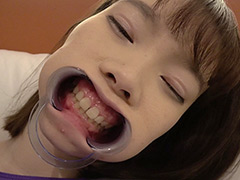 口腔：高梨有紗ちゃんの超超超激レアの歯・口内観察！！