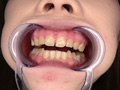 [adoa-0534] 高梨有紗ちゃんの超超超激レアの歯・口内観察！！のキャプチャ画像 2