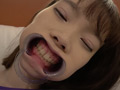 [adoa-0534] 高梨有紗ちゃんの超超超激レアの歯・口内観察！！のキャプチャ画像 5