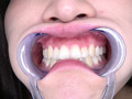 [adoa-0558] 星あめりチャンの歯＆舌ベロ口内観察・涎垂らし作品のキャプチャ画像 5