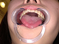 篠原りこの歯・口内・舌ベロ・涎・のどちんこ観察！ サンプル画像10