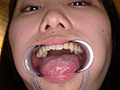 篠原りこの歯・口内・舌ベロ・涎・のどちんこ観察！ サンプル画像11