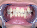 [adoa-0579] 真白わかなチャンの激レアな歯・口内・のどちんこ観察！のキャプチャ画像 4