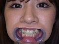 [adoa-0579] 真白わかなチャンの激レアな歯・口内・のどちんこ観察！のキャプチャ画像 5